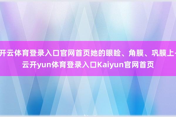 开云体育登录入口官网首页她的眼睑、角膜、巩膜上-云开yun体育登录入口Kaiyun官网首页